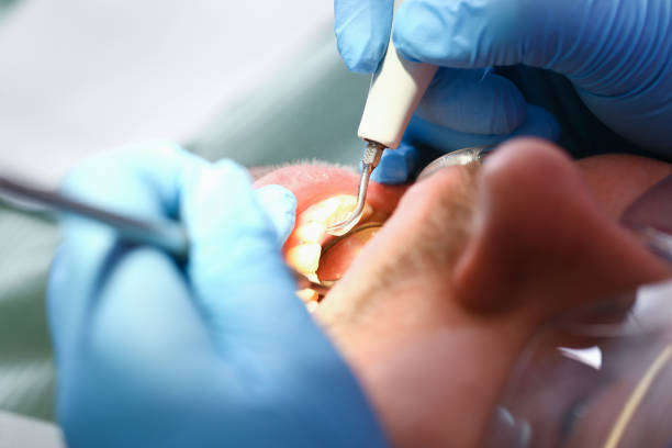 Best Emergency Dentist Near Me  in Carterville, MO